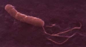 Helicobacter pylori